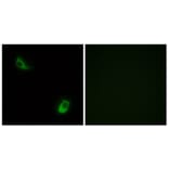 Immunofluorescence - Anti-FPRL2 Antibody (G104) - Antibodies.com