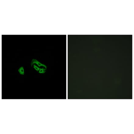 Immunofluorescence - Anti-FPRL2 Antibody (G252) - Antibodies.com