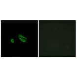 Immunofluorescence - Anti-FPRL2 Antibody (G252) - Antibodies.com