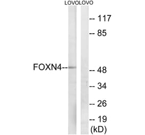 Western Blot - Anti-FOXN4 Antibody (C15798) - Antibodies.com