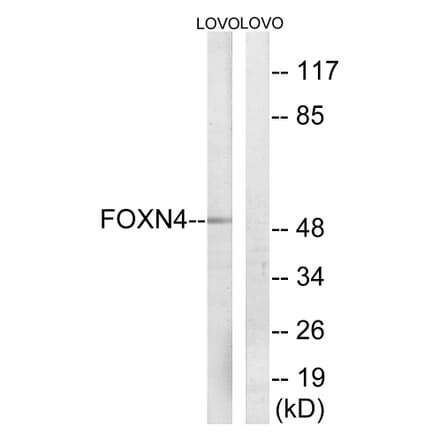 Western Blot - Anti-FOXN4 Antibody (C15798) - Antibodies.com