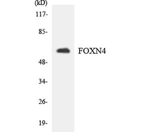 Western Blot - Anti-FOXN4 Antibody (R12-2778) - Antibodies.com