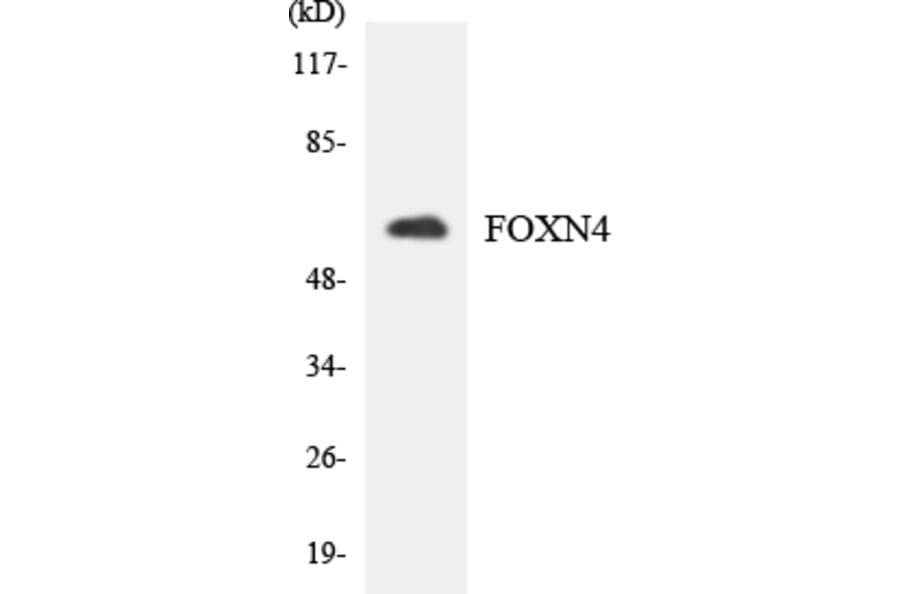 Western Blot - Anti-FOXN4 Antibody (R12-2778) - Antibodies.com