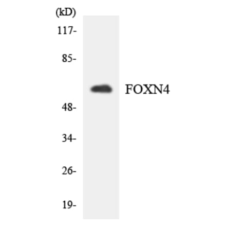 Western Blot - Anti-FOXN4 Antibody (R12-2778) - Antibodies.com