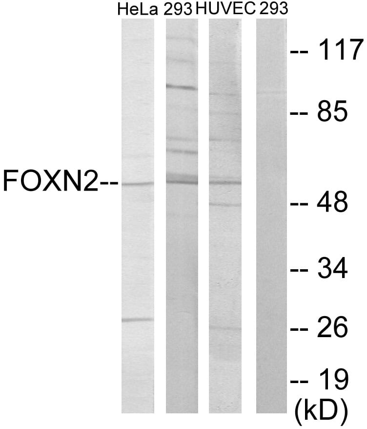 Western blot analysis of lysates from HeLa, 293, and HUVEC cells using Anti-FOXN2 Antibody. The right hand lane represents a negative control, where the antibody is blocked by the immunising peptide.