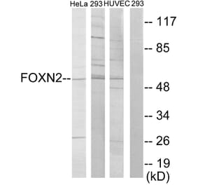 Western Blot - Anti-FOXN2 Antibody (C10537) - Antibodies.com