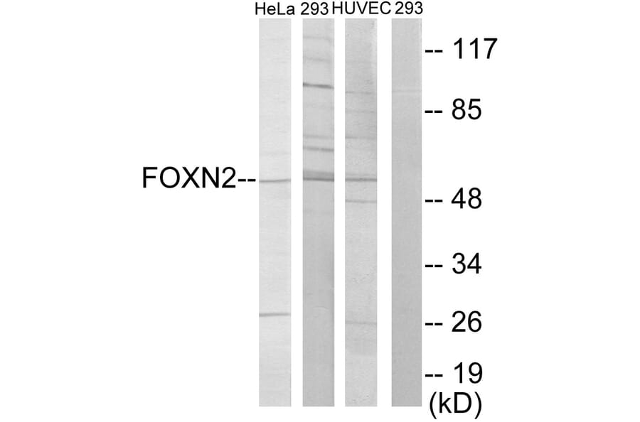 Western Blot - Anti-FOXN2 Antibody (C10537) - Antibodies.com