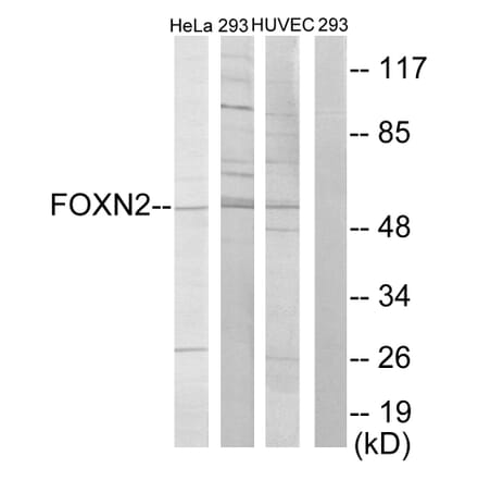 Western Blot - Anti-FOXN2 Antibody (C10537) - Antibodies.com