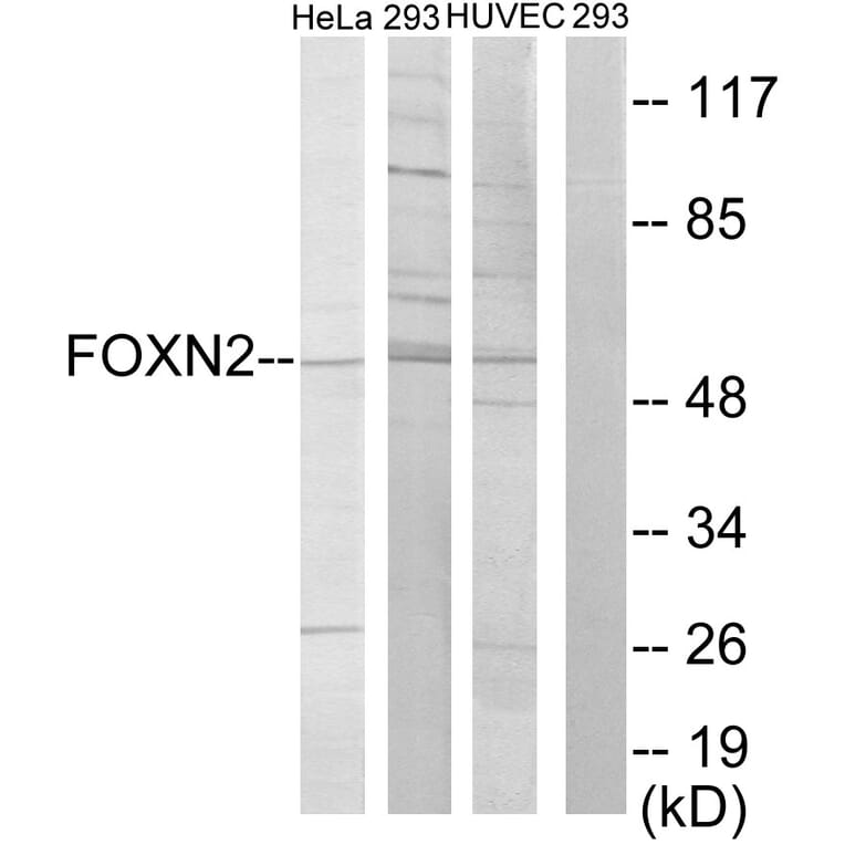 Western Blot - Anti-FOXN2 Antibody (C10537) - Antibodies.com