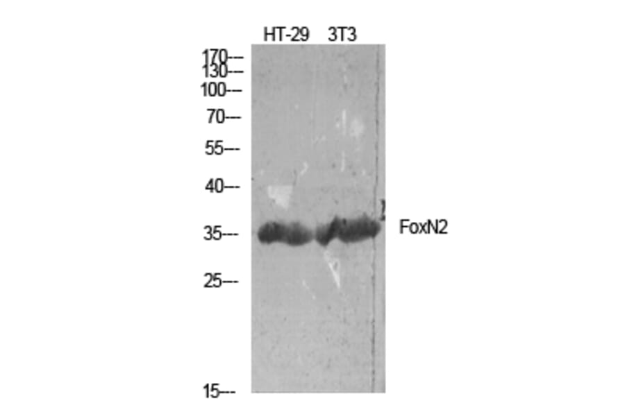 Western Blot - Anti-FOXN2 Antibody (C10537) - Antibodies.com