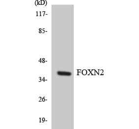 Western Blot - Anti-FOXN2 Antibody (R12-2777) - Antibodies.com
