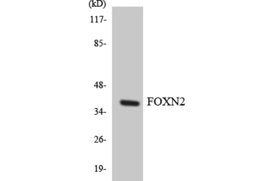 Western Blot - Anti-FOXN2 Antibody (R12-2777) - Antibodies.com