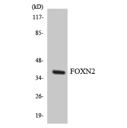Western Blot - Anti-FOXN2 Antibody (R12-2777) - Antibodies.com
