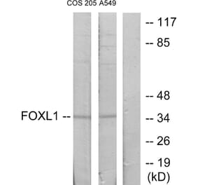 Western Blot - Anti-FOXL1 Antibody (C10939) - Antibodies.com