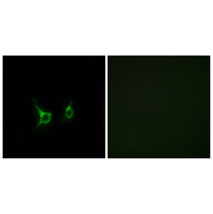 Immunofluorescence - Anti-FFAR2 Antibody (G249) - Antibodies.com