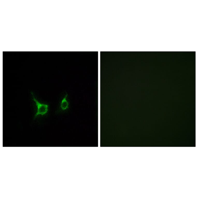 Immunofluorescence - Anti-FFAR2 Antibody (G249) - Antibodies.com