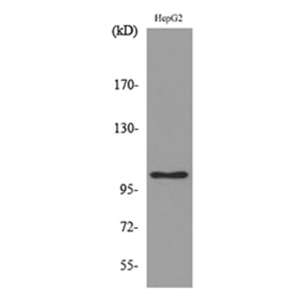 Western Blot - Anti-FCRL5 Antibody (C30458) - Antibodies.com