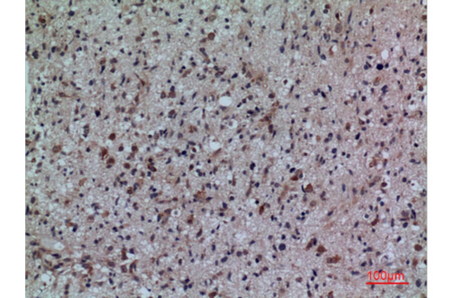 Immunohistochemistry - Anti-FCRL5 Antibody (C30458) - Antibodies.com
