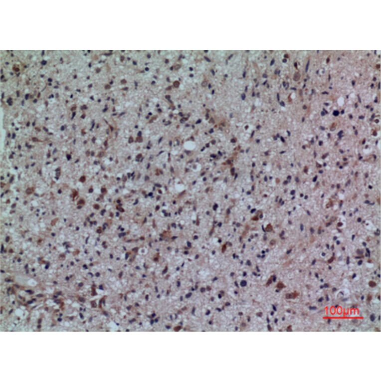 Immunohistochemistry - Anti-FCRL5 Antibody (C30458) - Antibodies.com
