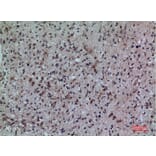Immunohistochemistry - Anti-FCRL5 Antibody (C30458) - Antibodies.com