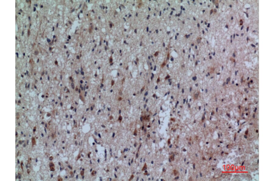 Immunohistochemistry - Anti-FCRL5 Antibody (C30458) - Antibodies.com