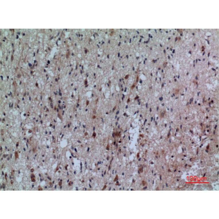 Immunohistochemistry - Anti-FCRL5 Antibody (C30458) - Antibodies.com
