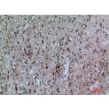 Immunohistochemistry - Anti-FCRL5 Antibody (C30458) - Antibodies.com