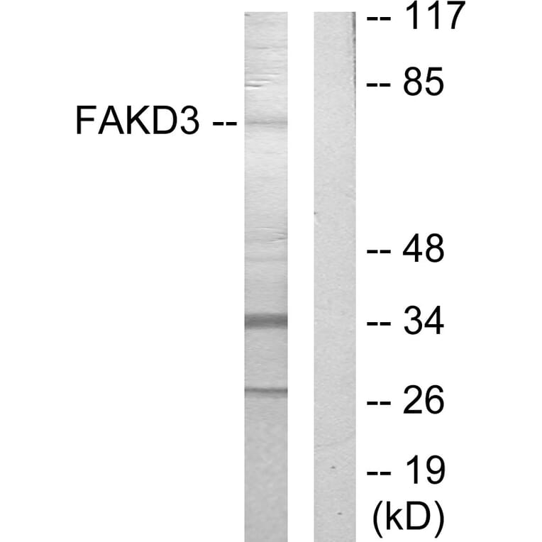 Western Blot - Anti-FAKD3 Antibody (C11055) - Antibodies.com