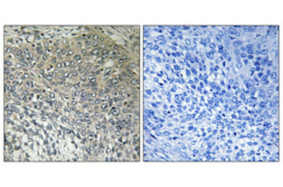 Immunohistochemistry - Anti-FAKD3 Antibody (C11055) - Antibodies.com