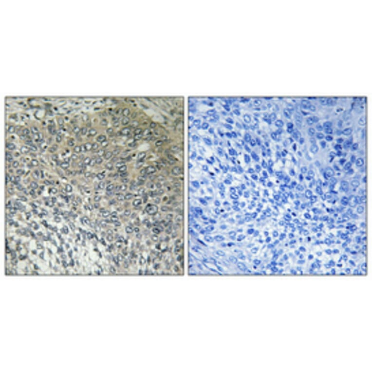 Immunohistochemistry - Anti-FAKD3 Antibody (C11055) - Antibodies.com