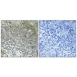 Immunohistochemistry - Anti-FAKD3 Antibody (C11055) - Antibodies.com