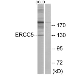 Western Blot - Anti-ERCC5 Antibody (C10503) - Antibodies.com
