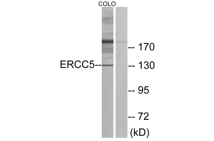 Western Blot - Anti-ERCC5 Antibody (C10503) - Antibodies.com
