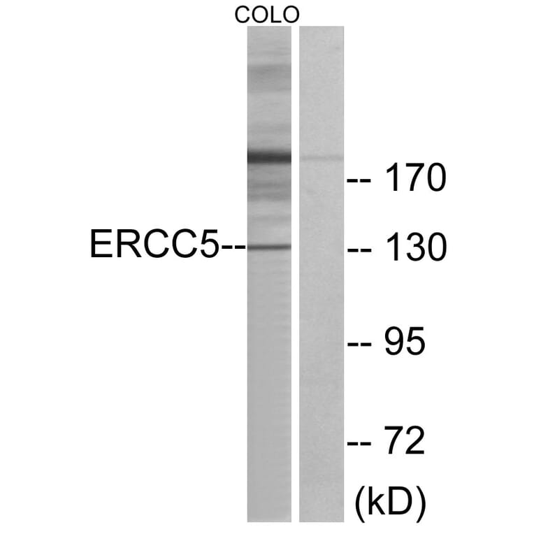 Western Blot - Anti-ERCC5 Antibody (C10503) - Antibodies.com
