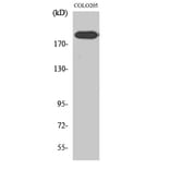 Western Blot - Anti-ERCC5 Antibody (C10503) - Antibodies.com
