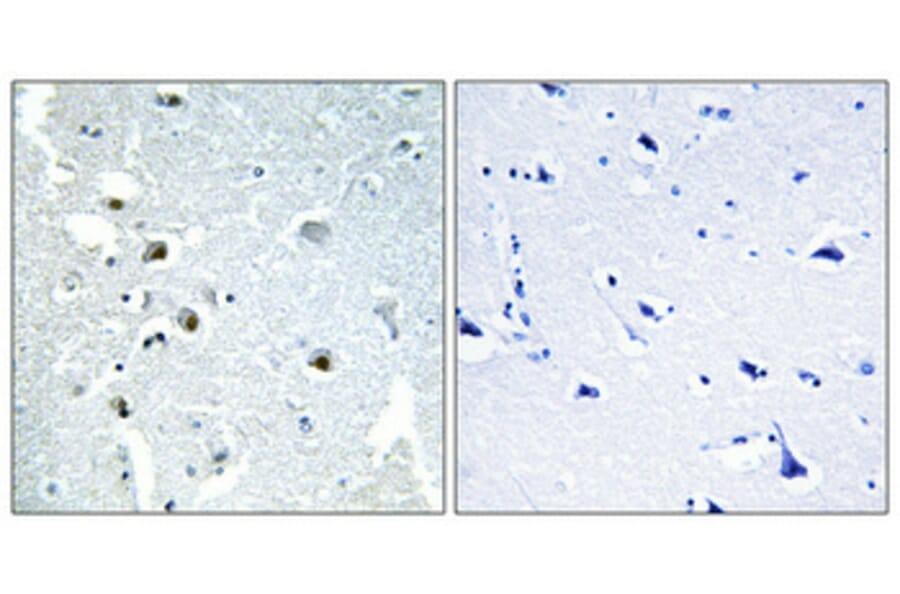 Immunohistochemistry - Anti-ERCC5 Antibody (C10503) - Antibodies.com