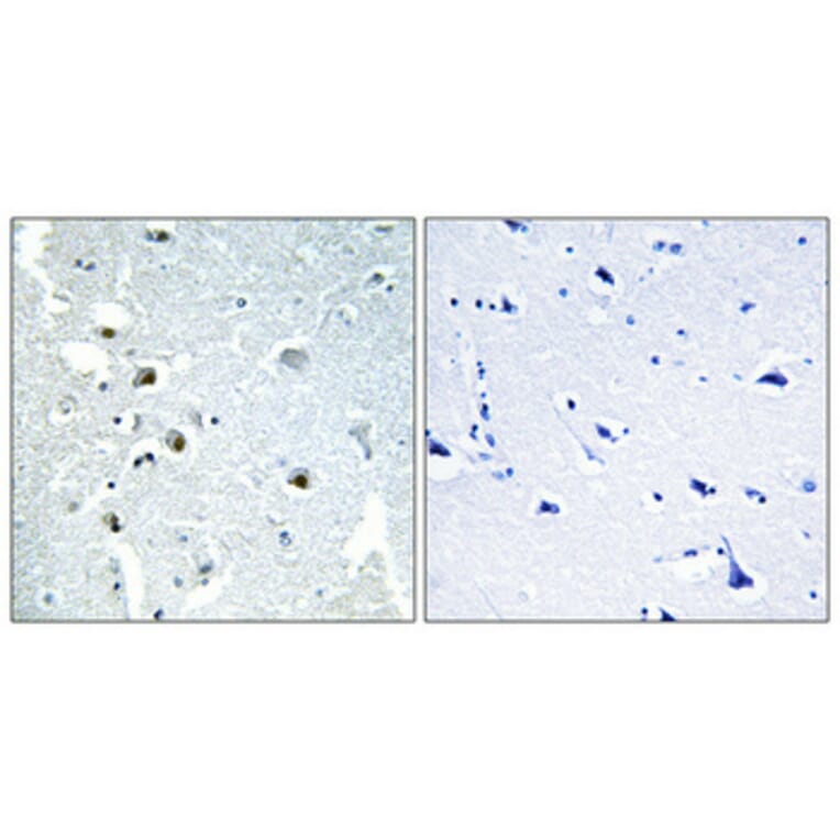 Immunohistochemistry - Anti-ERCC5 Antibody (C10503) - Antibodies.com