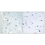 Immunohistochemistry - Anti-ERCC5 Antibody (C10503) - Antibodies.com