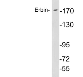 Western Blot - Anti-Erbin Antibody (R12-2138) - Antibodies.com