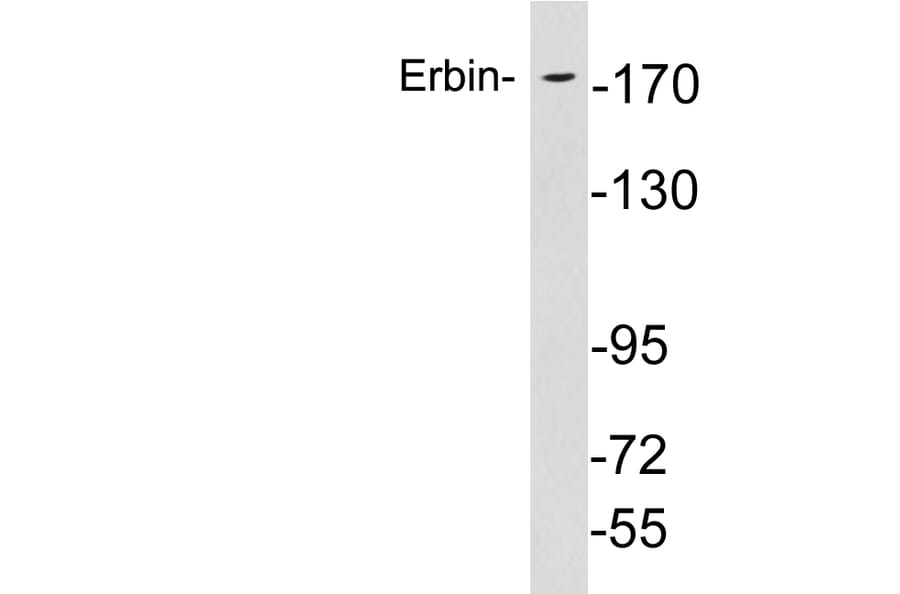Western Blot - Anti-Erbin Antibody (R12-2138) - Antibodies.com