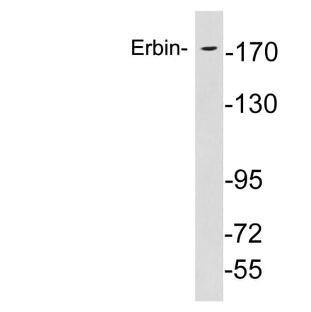 Western Blot - Anti-Erbin Antibody (R12-2138) - Antibodies.com