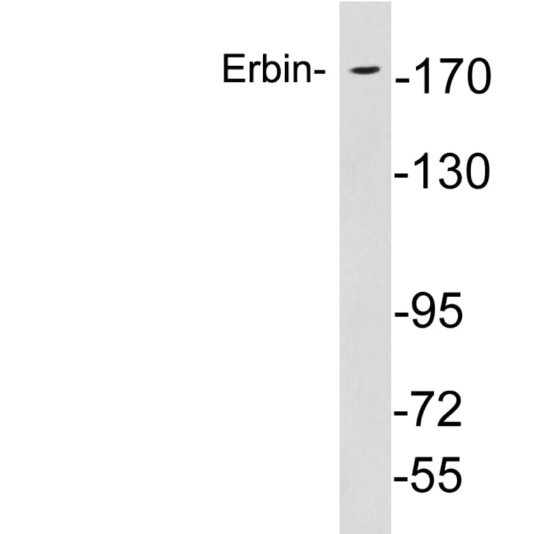 Western Blot - Anti-Erbin Antibody (R12-2138) - Antibodies.com