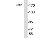 Western Blot - Anti-Erbin Antibody (R12-2138) - Antibodies.com