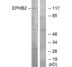 Western Blot - Anti-EPHB2 Antibody (C10510) - Antibodies.com