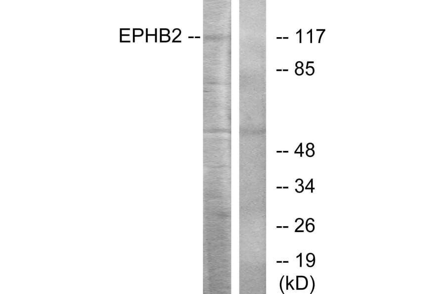 Western Blot - Anti-EPHB2 Antibody (C10510) - Antibodies.com