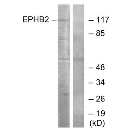 Western Blot - Anti-EPHB2 Antibody (C10510) - Antibodies.com