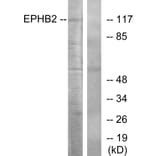 Western Blot - Anti-EPHB2 Antibody (C10510) - Antibodies.com