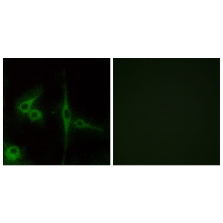Immunofluorescence - Anti-ELTD1 Antibody (G100) - Antibodies.com