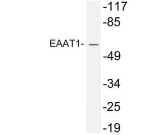 Western Blot - Anti-EAAT1 Antibody (R12-2120) - Antibodies.com