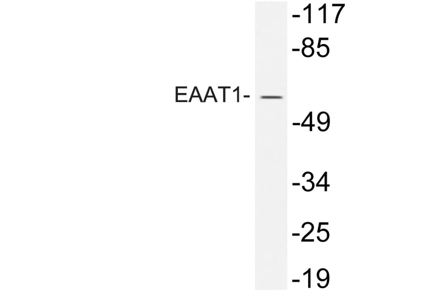 Western Blot - Anti-EAAT1 Antibody (R12-2120) - Antibodies.com